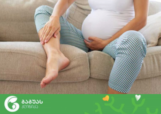 ქვემო კიდურების შეშუპება ორსულობის დროს